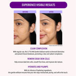AHA Gentle Exfoliant