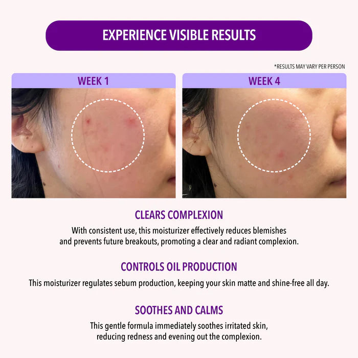 Niacinamide Oil Control Moisturizer