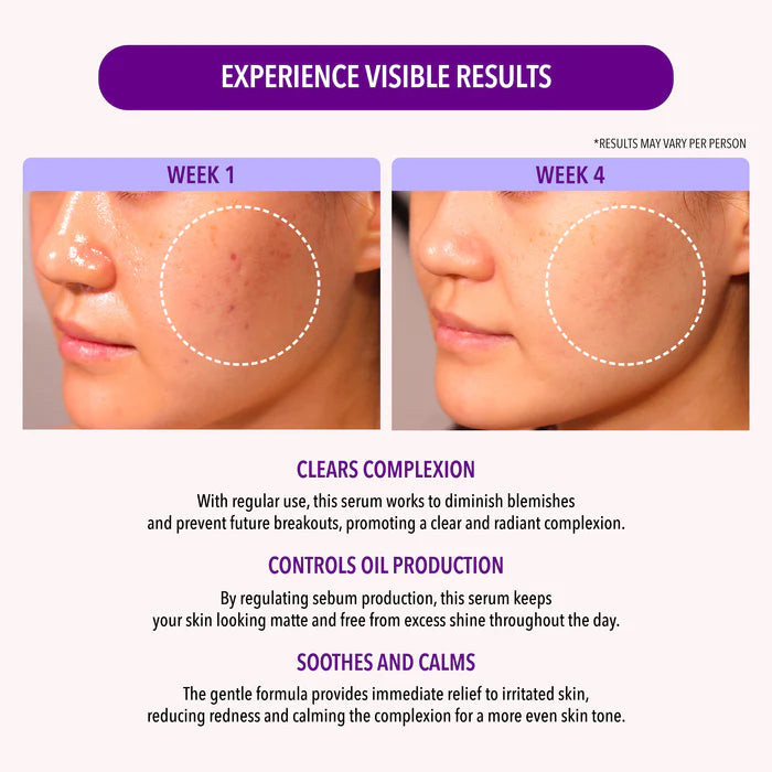 Salicylic Acid Oil Control Serum